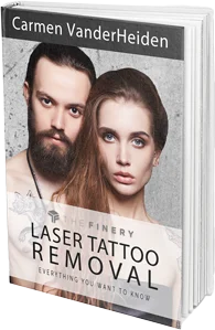 Laser Tattoo Removal by Carmen Vanderheiden | Become A Published Author